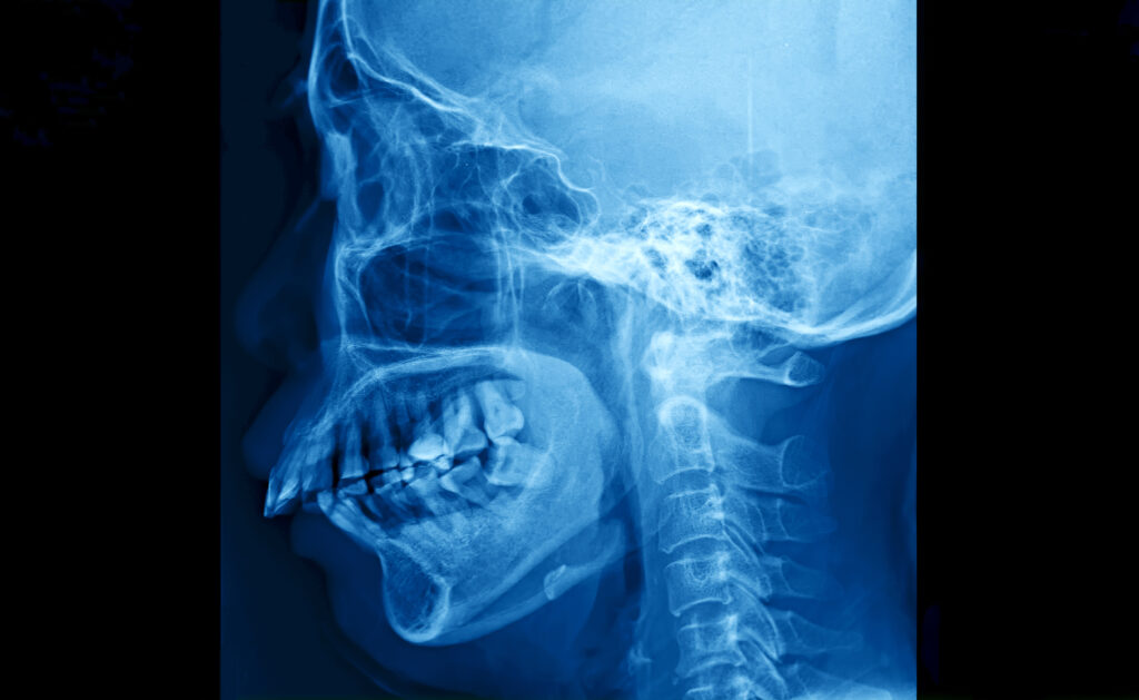 skull picture from throat doctor 